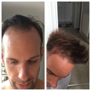 joehair1 300x300 - Hair Salon in Newton Abbot, Devon