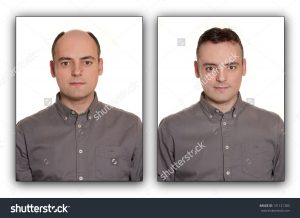 stock photo bald man with a wig before after concept 131121383 300x218 - Hair Salon in Newton Abbot, Devon